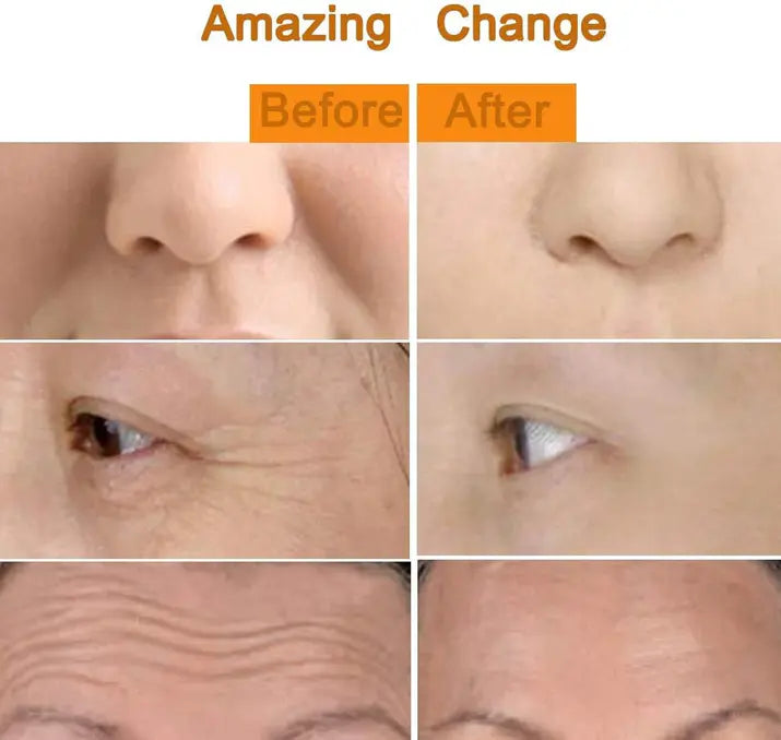 ZestoTouch™ - 24K Gold Electric Facial Massage