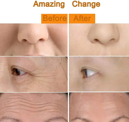 ZestoTouch™ - 24K Gold Electric Facial Massage